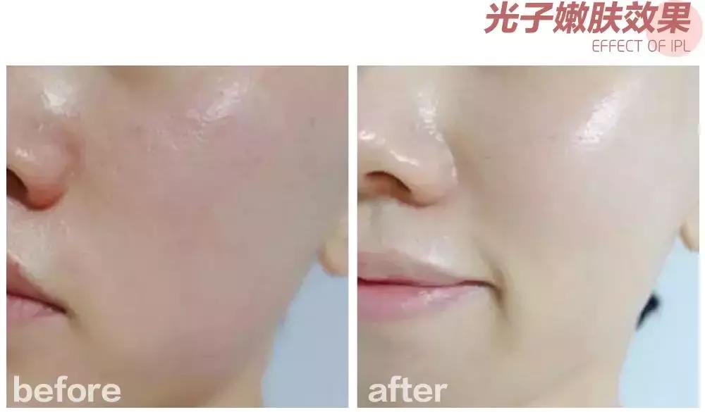 1元做女神不是梦!这家素颜改造基地,躺着就能变美