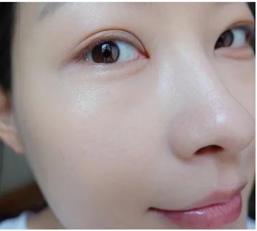 鼻子两侧毛孔粗大是什么原因,毛孔粗大原因及如何改善