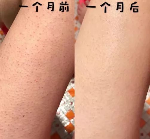 乳木果润肤裤穿搭,乳木果润肤保湿裤