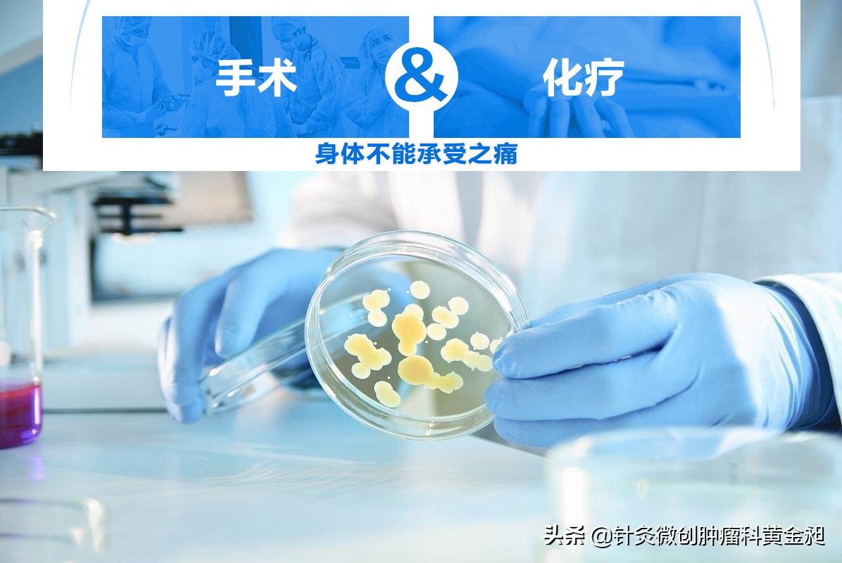 化疗期间恶心呕吐便秘如何缓解,化疗后恶心呕吐哪个穴位能缓解