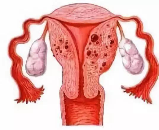 有哪些妇科疾病是正常的,你知道吗有些妇科病其实不用治