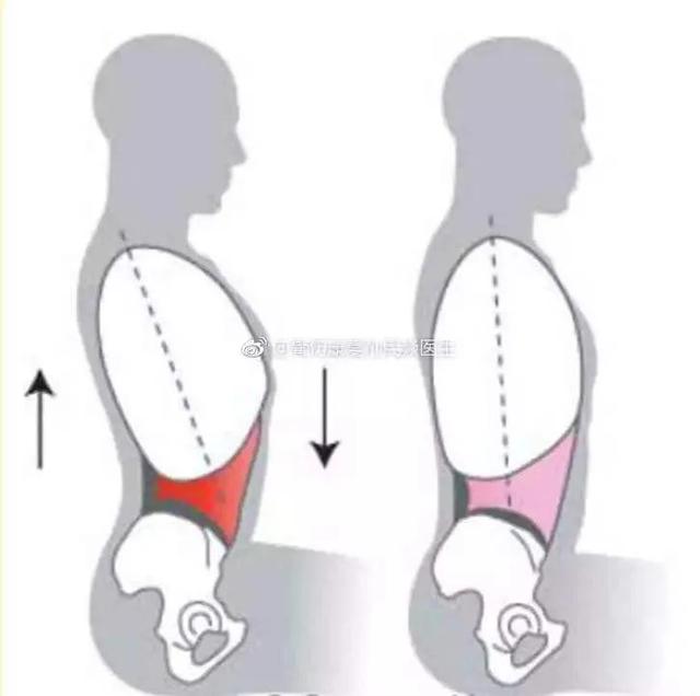肋骨外翻生活体态怎么调整,体态矫正可以治疗肋骨外翻吗