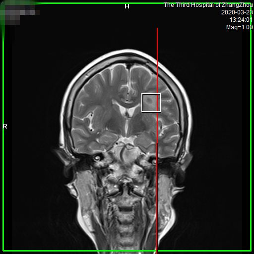 漳州市第三医院预约做磁共振,3.0t核磁共振广东哪里可以做