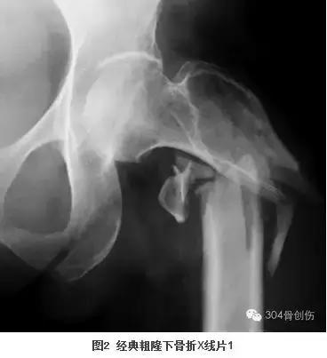 循证医学学习指导,循证医学连续病例