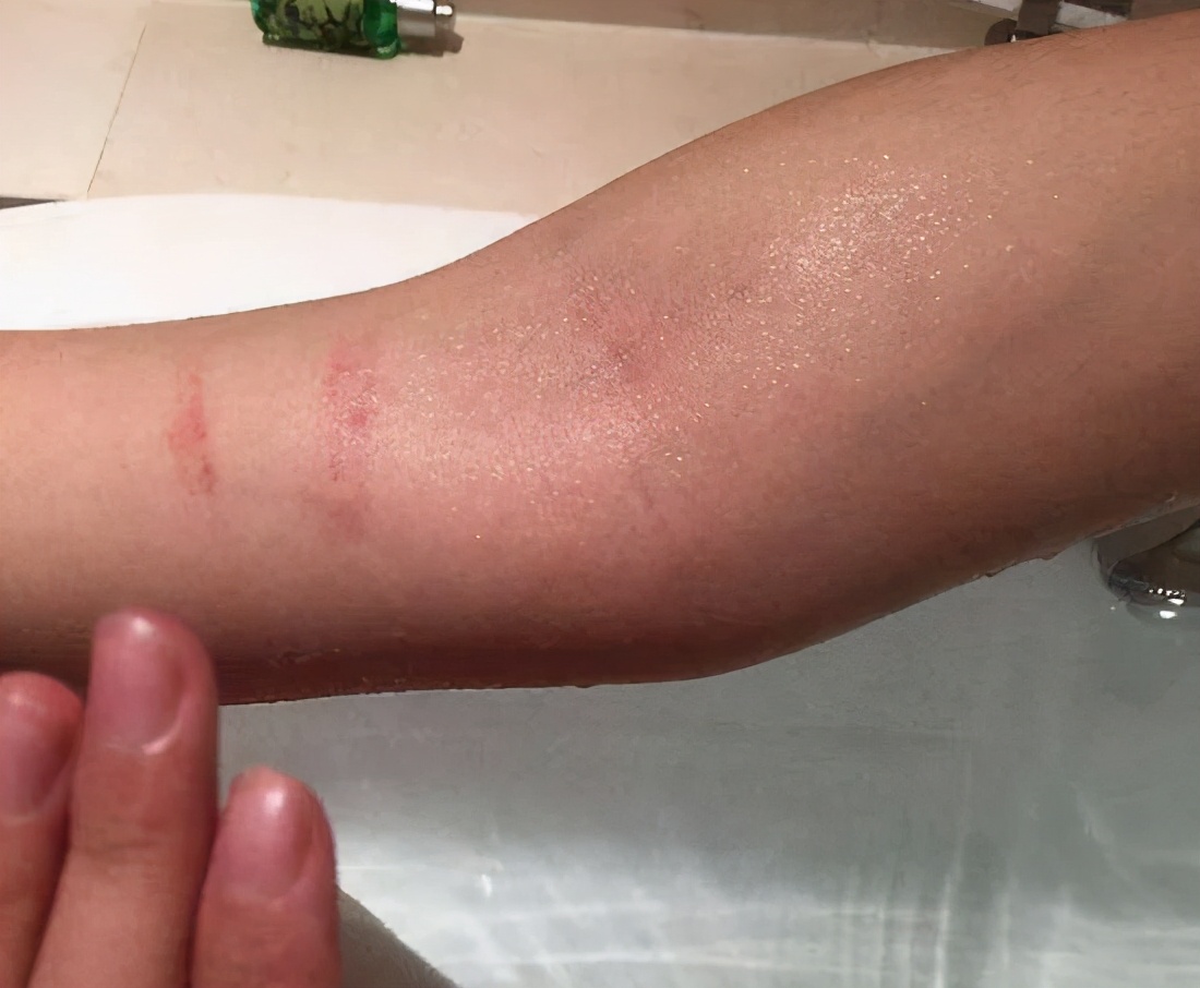 女孩坐黑车遭司机侵害,女子遭黑车司机侵害