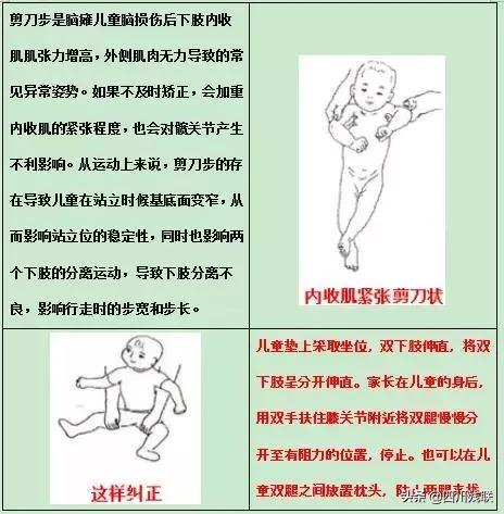 四川脑瘫康复训练有效果吗,成都脑瘫恢复中心