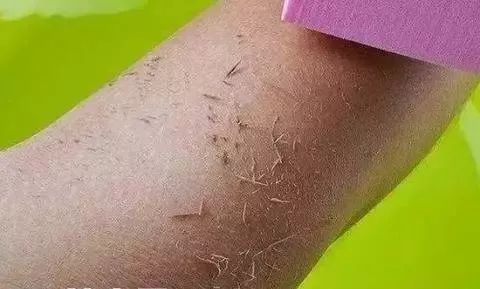 洗澡时搓下来的泥是什么?在显微镜下放大一百倍,看后让人不舒服