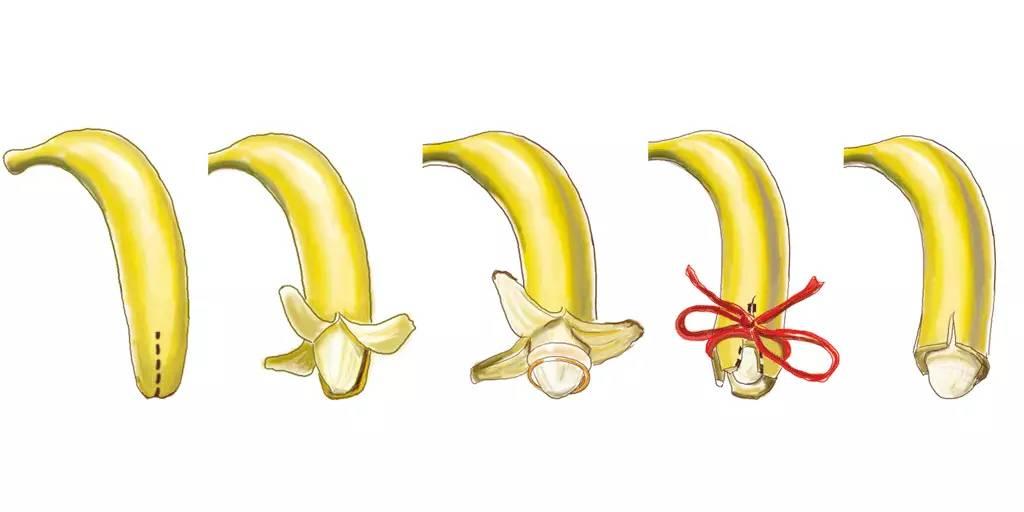 包皮手术幼儿科普,男人做包皮手术