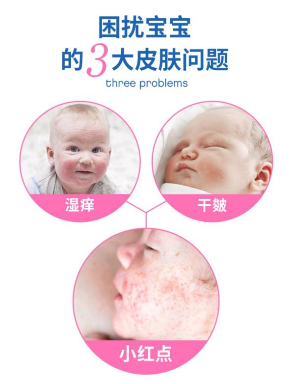 孩子皮肤干燥怎么护肤好,小孩皮肤太干燥怎么调理