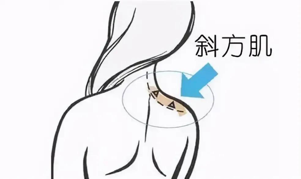 瘦斜方肌直角肩天鹅颈一周训练,女性斜方肌厚怎么治