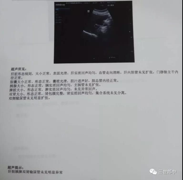 27岁女性胆囊息肉能自愈吗,7mm胆囊息肉会消失吗