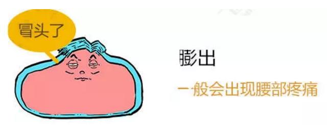 此文章让你彻底明白什么是:腰间盘突出