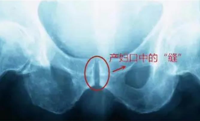 无法控制小便怎么办,为什么生完宝宝后尿的次数多了