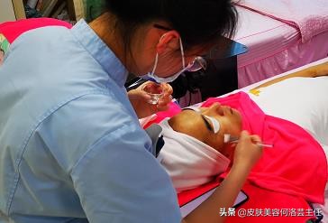 脸上有皱纹最快的去皱方法,脸上的皱纹用什么办法去皱效果好