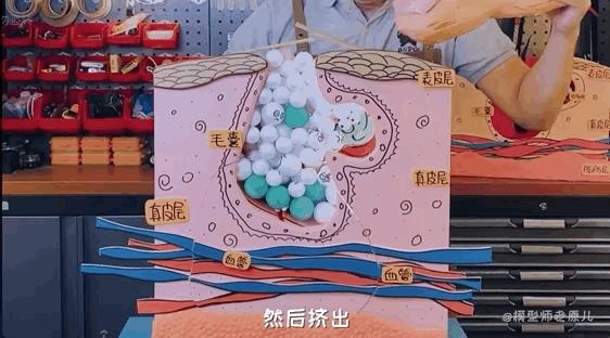 模型师老原儿手被烫伤,模型师老原儿被烫伤