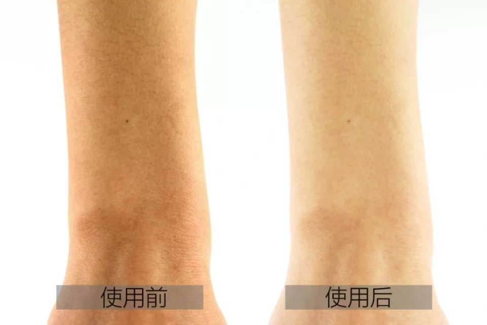 痘痘留下的黑色素可以自己消失吗,瘙痒异味用什么洗