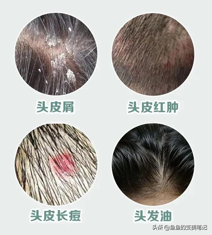 丝蕴滋源洗发水测评,洗发水推荐干性滋源