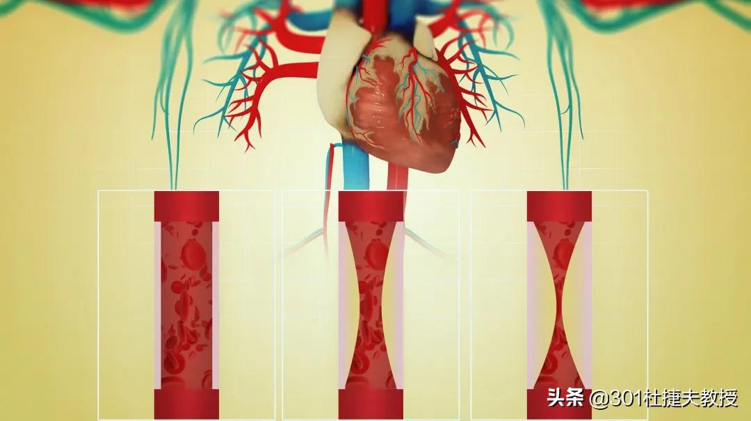 冠脉全闭塞是放支架好还是搭桥好,冠脉完全闭塞非要放支架吗