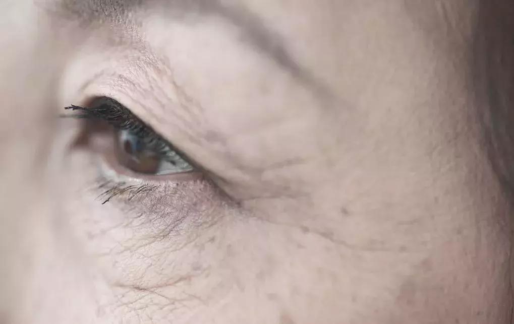 失眠气色差是什么原因,对抗失眠最有效方法