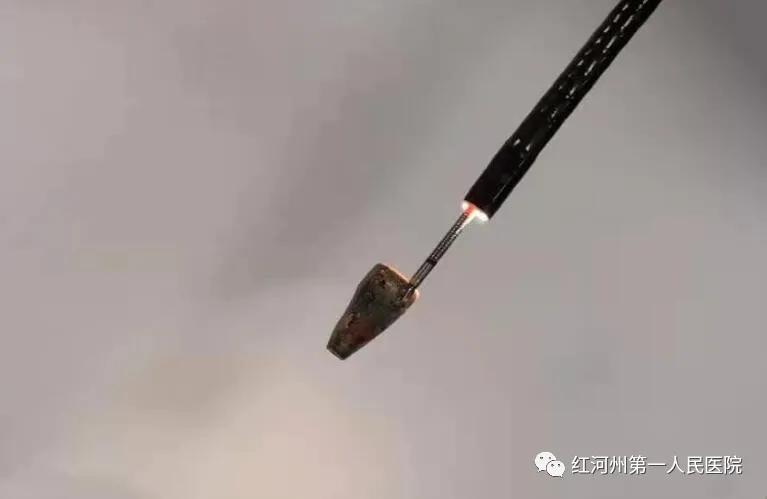 12岁男孩咳嗽三年了,13岁男孩半年咳嗽两次