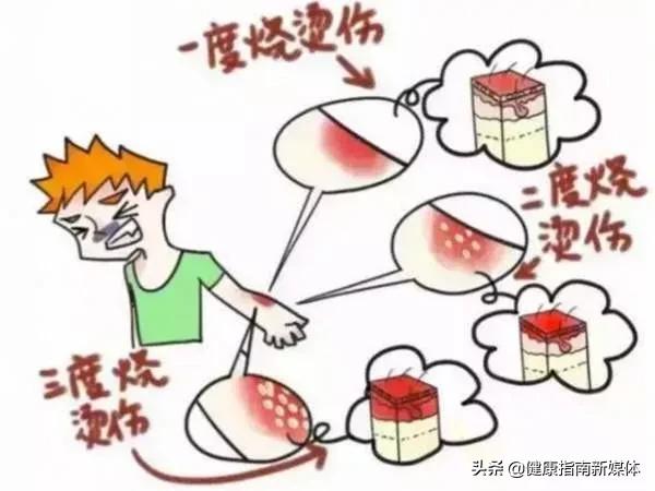 烧烫伤急救学习心得,老年人烧烫伤的自救方法