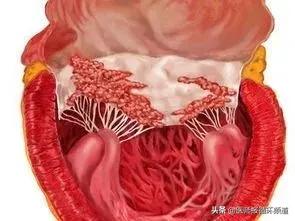 10岁孩子拔牙出事了,10岁女孩拔牙有危险吗