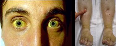 内分泌治疗吃的药物多吗,内分泌治疗可以外用雌激素吗