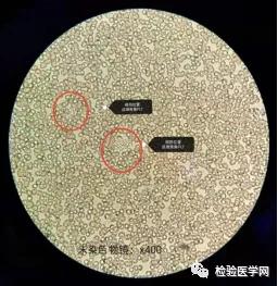 “秒”看血小板聚集，你get到了吗？