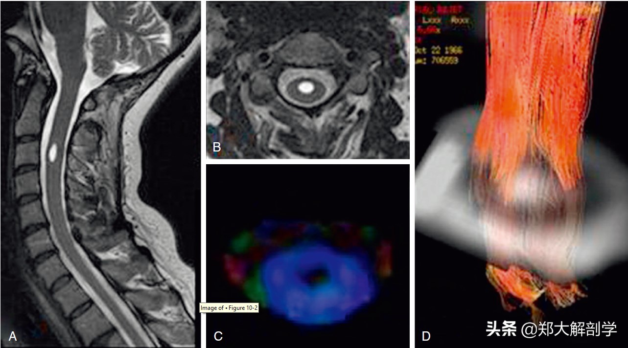 c6神经根受压,c6神经支配区域