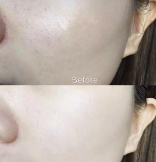 片仔癀代表护肤品,片仔癀护肤品是什么类型