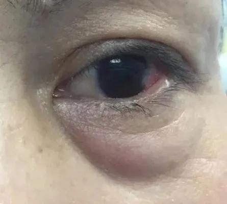 女明星增肥30斤又减回来太瘦,明星都有哪些增肥方法