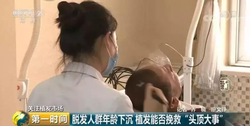 秃如其来视频完整版,秃如其来为哪般