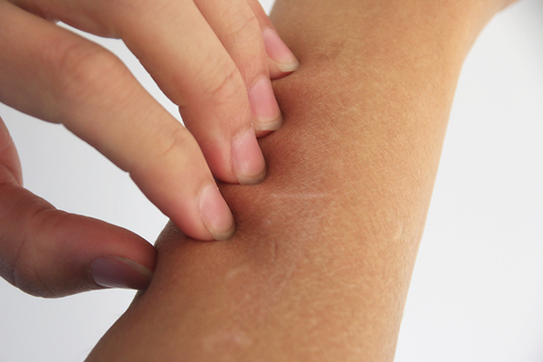 手上起小水泡很痒是湿疹还是过敏,水泡湿疹和汗疱疹区别