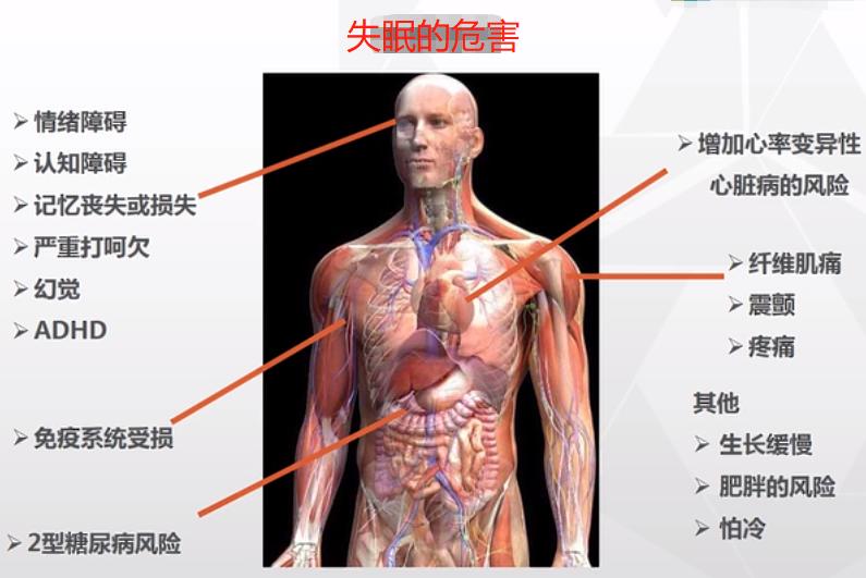 失眠头痛浑身无力怎么办,失眠了头疼怎么缓解