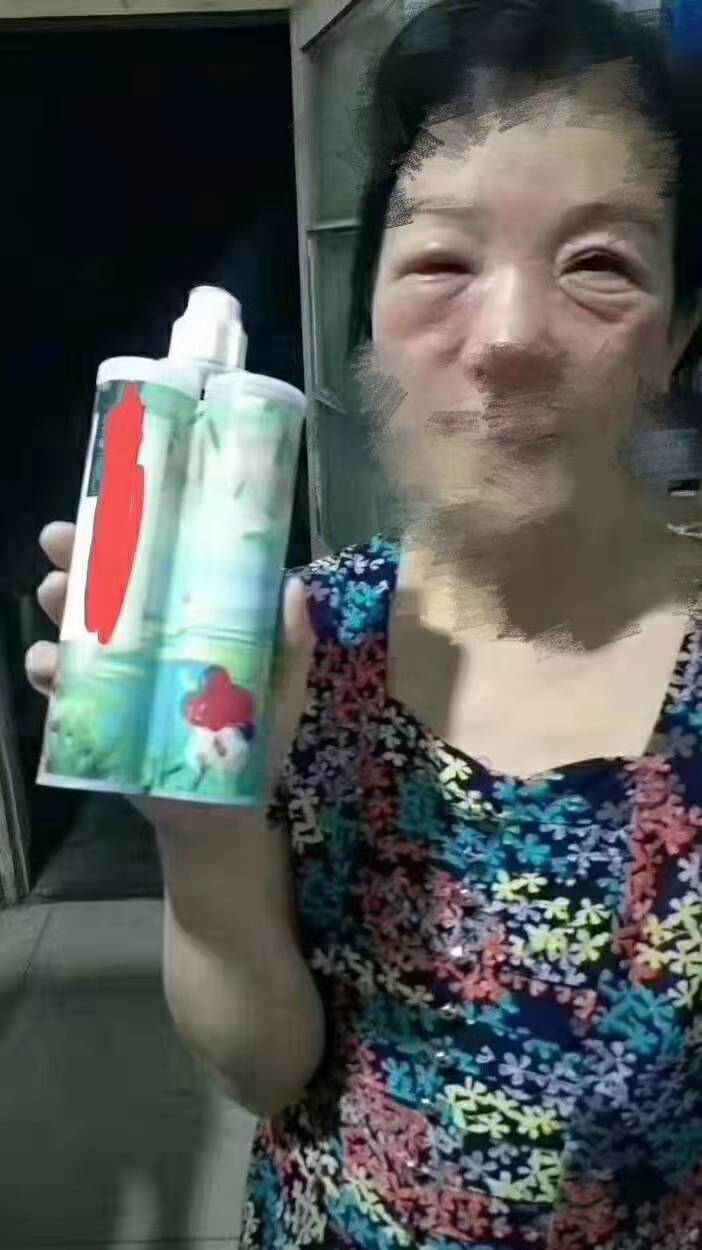 美缝的这些陷阱你还被蒙在鼓里吗,不要轻易相信美缝有多简单