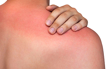 肺癌皮肤会出现哪些症状,肺癌发生时皮肤有什么异常表现