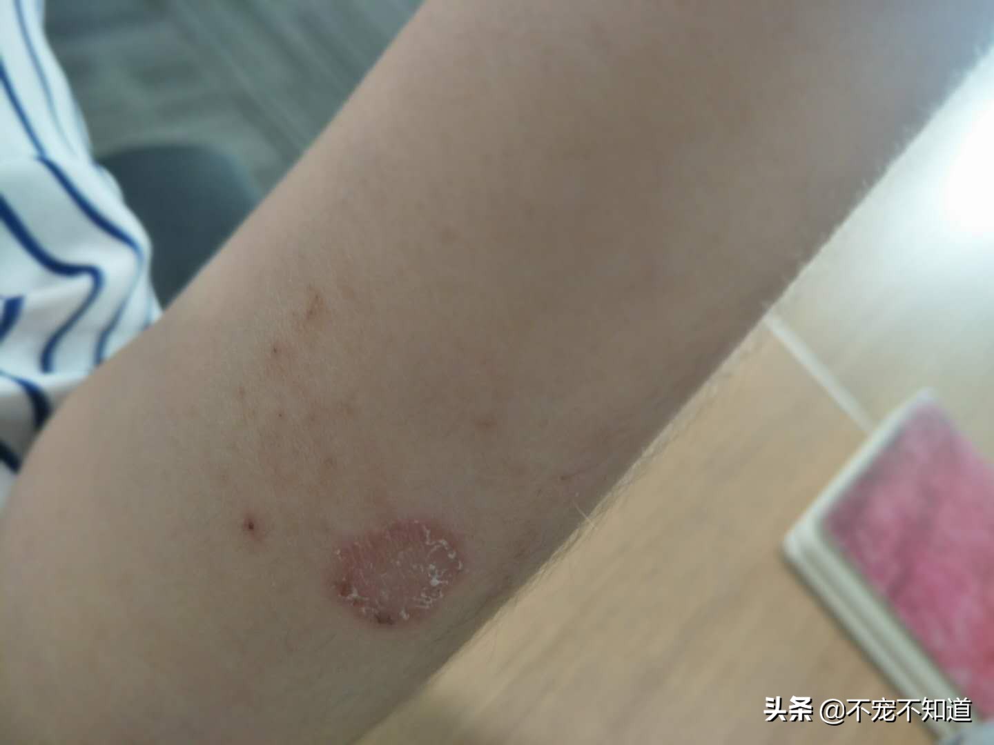 怎么判断猫癣是不是要好了,怎么快速辨别猫癣