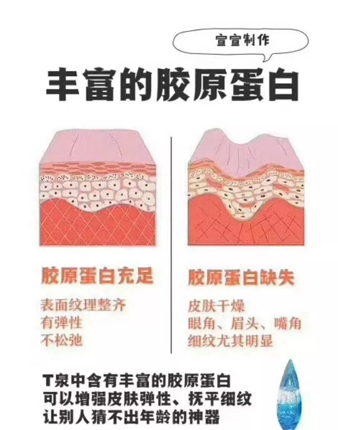 tgs活肤之泉精华水,tgs活肤之泉能淡化痘印吗