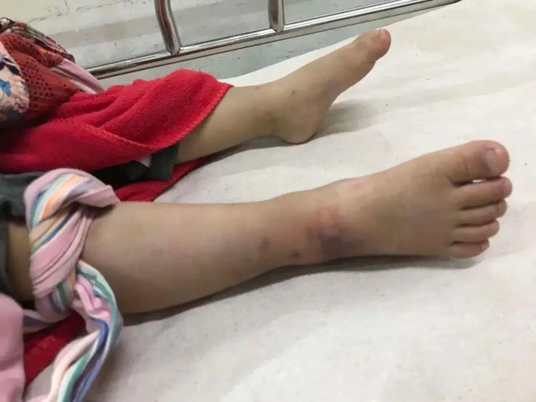 广西一马路上惊现十几条眼镜蛇,广西一马路上惊现十多条眼镜蛇