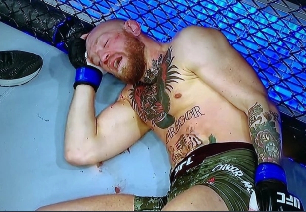 嘴炮腿骨受伤视频,嘴炮最新伤情报告