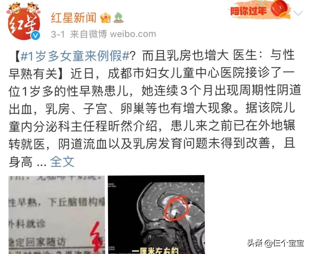 幼儿园小朋友长小胡子,幼儿园的孩子早熟