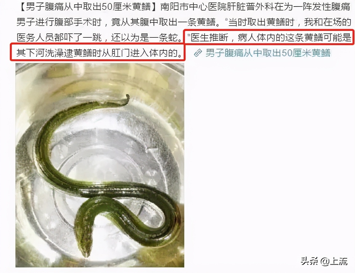 肛肠科医生的手指为什么这么粗,肛肠科医生用手指做检查