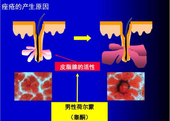 浠欎汉鎺岀棙鑲屼慨鎶よ啅,鐪嬪畬鐥樼棙浠ュ悗鎰熻鏇翠弗閲嶄簡
