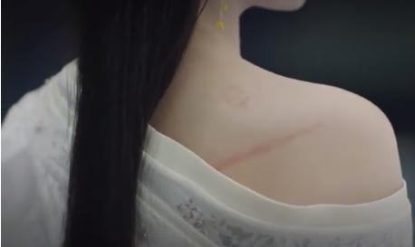 关于斑点你不知道的那些事,关于疤痕疙瘩你知道多少