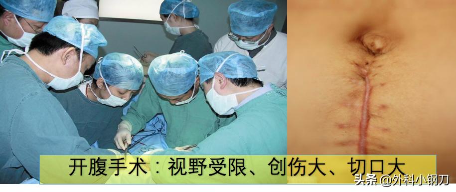 鍖荤敓鍓叉帀澶ц偁,鑲涢棬鍒囬櫎鍚庣画娌荤枟