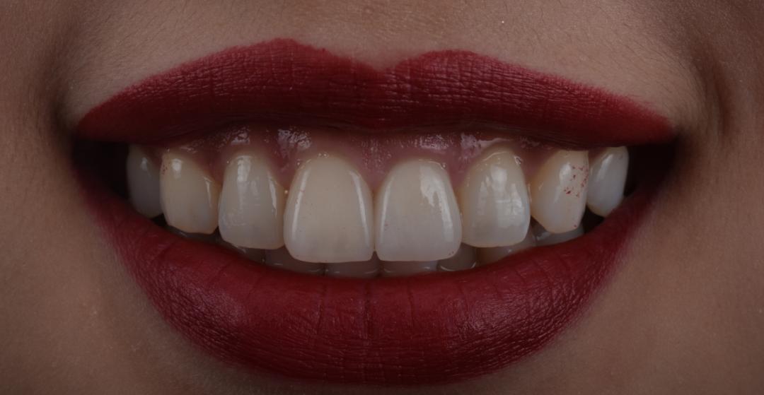 牙医从业感悟,牙医忠告11条