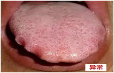 中医经典舌诊和中医全息舌诊区别,中医舌诊知识大全图片