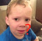 盆底肌保健意义,盆底肌修复可以治疗尿失禁吗