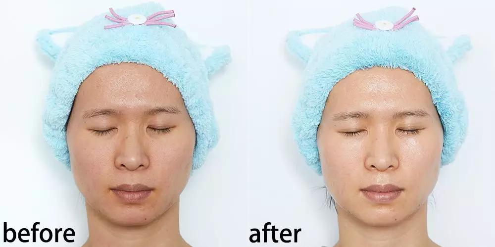 真人改造|不靠医美，一天实现“换皮”