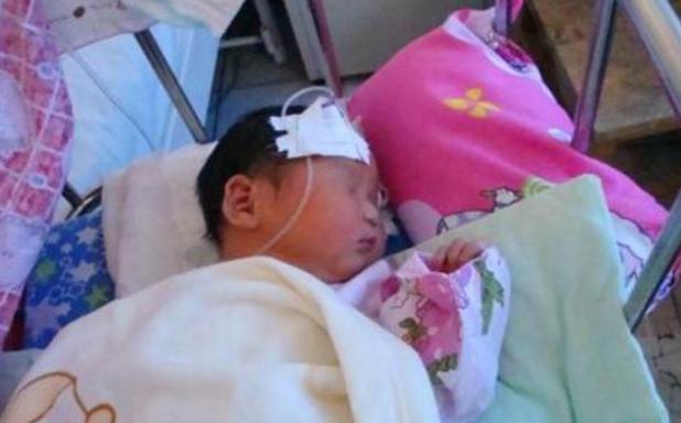 宝宝身上长黑刺妈妈一根根的拔掉,孩子身上长了黑刺